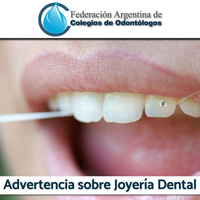 Advertencia sobre joyería dental
